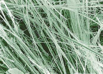 Mikroskopische Abbildung von Asbestfasern