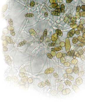Schimmel unter dem Mikroskop: Sporen und Pilzfäden der Gattung Ulocladium chartarum